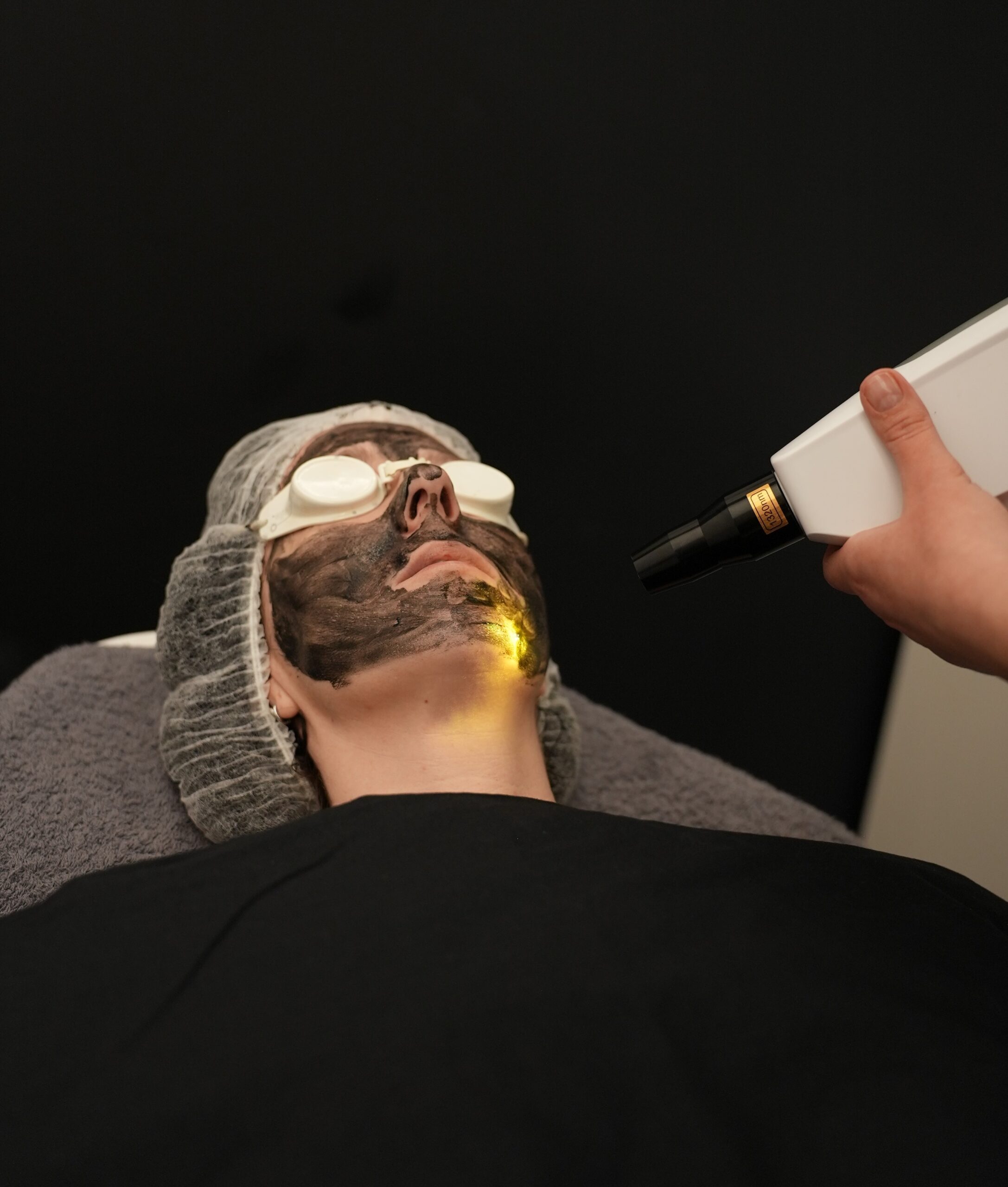 PEELING CARBONO+ HIGIENE CARLA